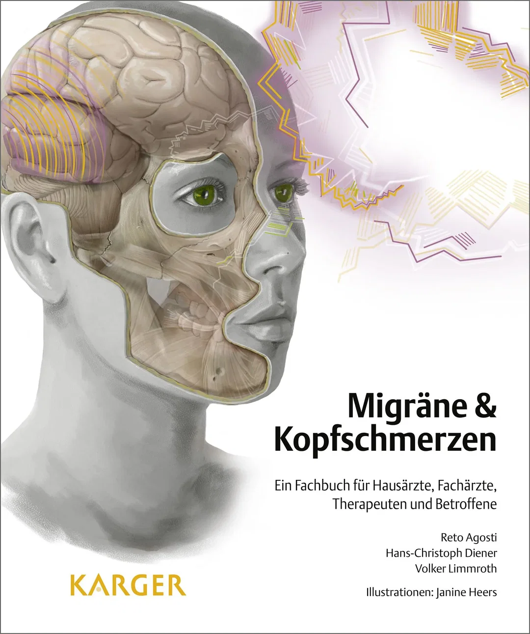 Migräne und Kopfschmerzen – Bild 1